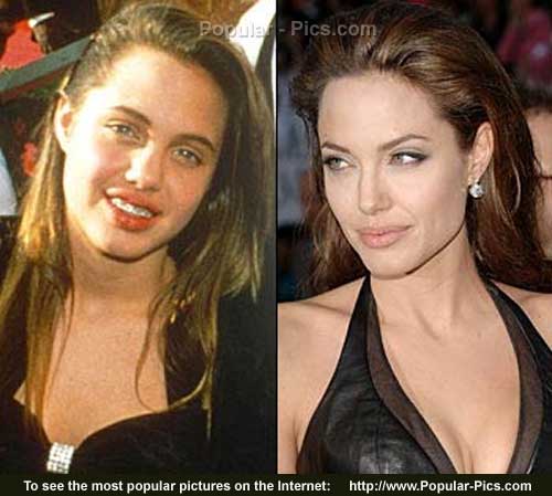 Stars Before and After - Angelina Jolie